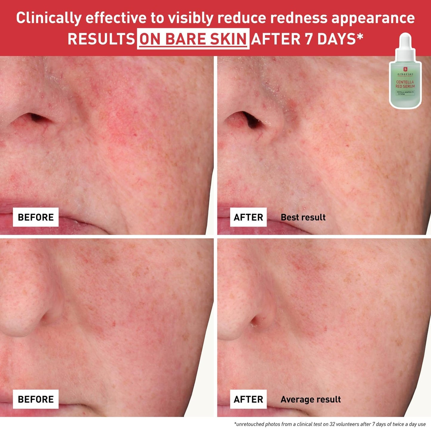 CENTELLA RED SERUM 10ML - dailyvitalstore