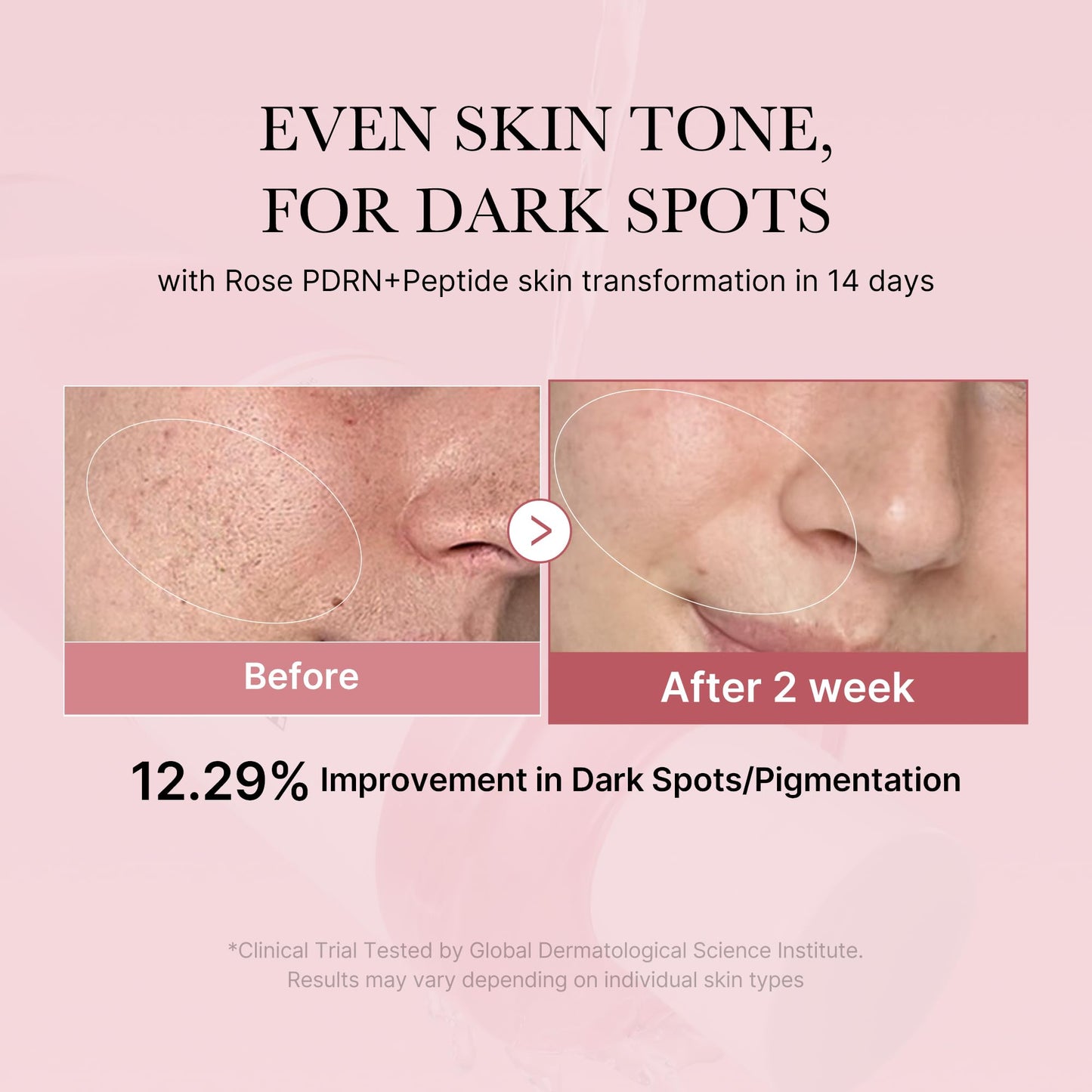 medicube PDRN Toner Rose PDRN Peptide Toner | Lightweight & Watery Type for Skin Boosting, Soothing and Calming, Uneven Skin Tone | with Rose, Peptide, Niacinamide | Korean Skincare, 8.45 fl.oz - dailyvitalstore