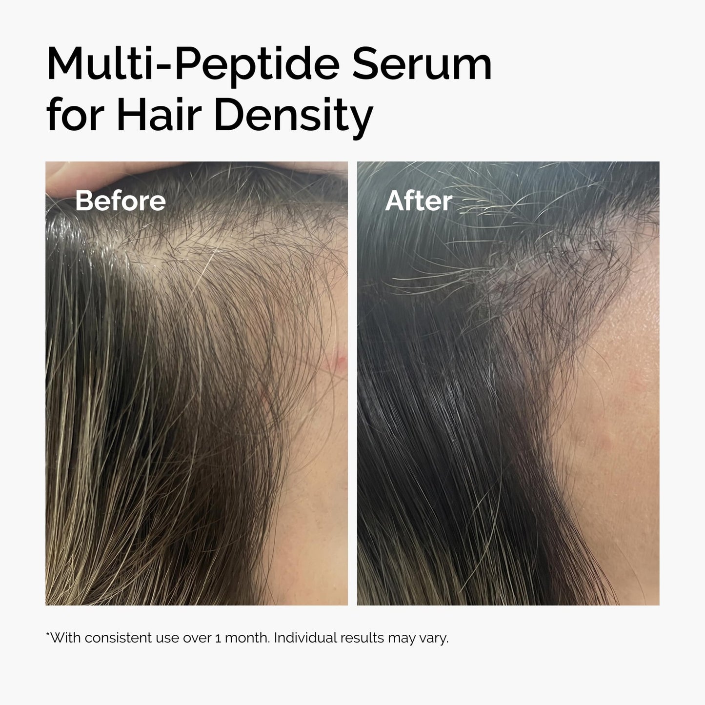 The Ordinary Multi-Peptide Serum for Hair Density, Peptide-Powered Formula for Thicker, Fuller Looking Hair, 2 Fl Oz - dailyvitalstore
