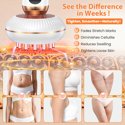 4-in-1 Body Sculpting Machine - Lymphatic Drainage Massager - Anit Cellulite Massage Tool Help Reduce Stretch Marks & Cellulite & Fat, Pain Relife Devices for Body (Belly, Legs, Arms, Butt, Low Back) - dailyvitalstore