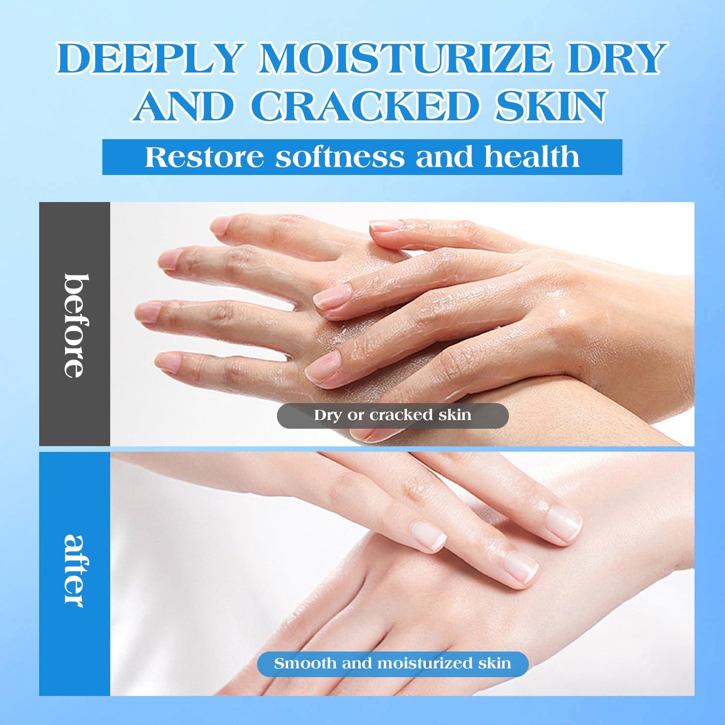 42% Urea Cream for Dry & Cracked Skin - Foot & Hand Cream with 2% Salicylic Acid, 5% Vitamin E, Tea Tree Oil, Aloe Vera, Shea Butter - Moisturizer & Skin Repair Cream for Feet Maximum Strength - dailyvitalstore