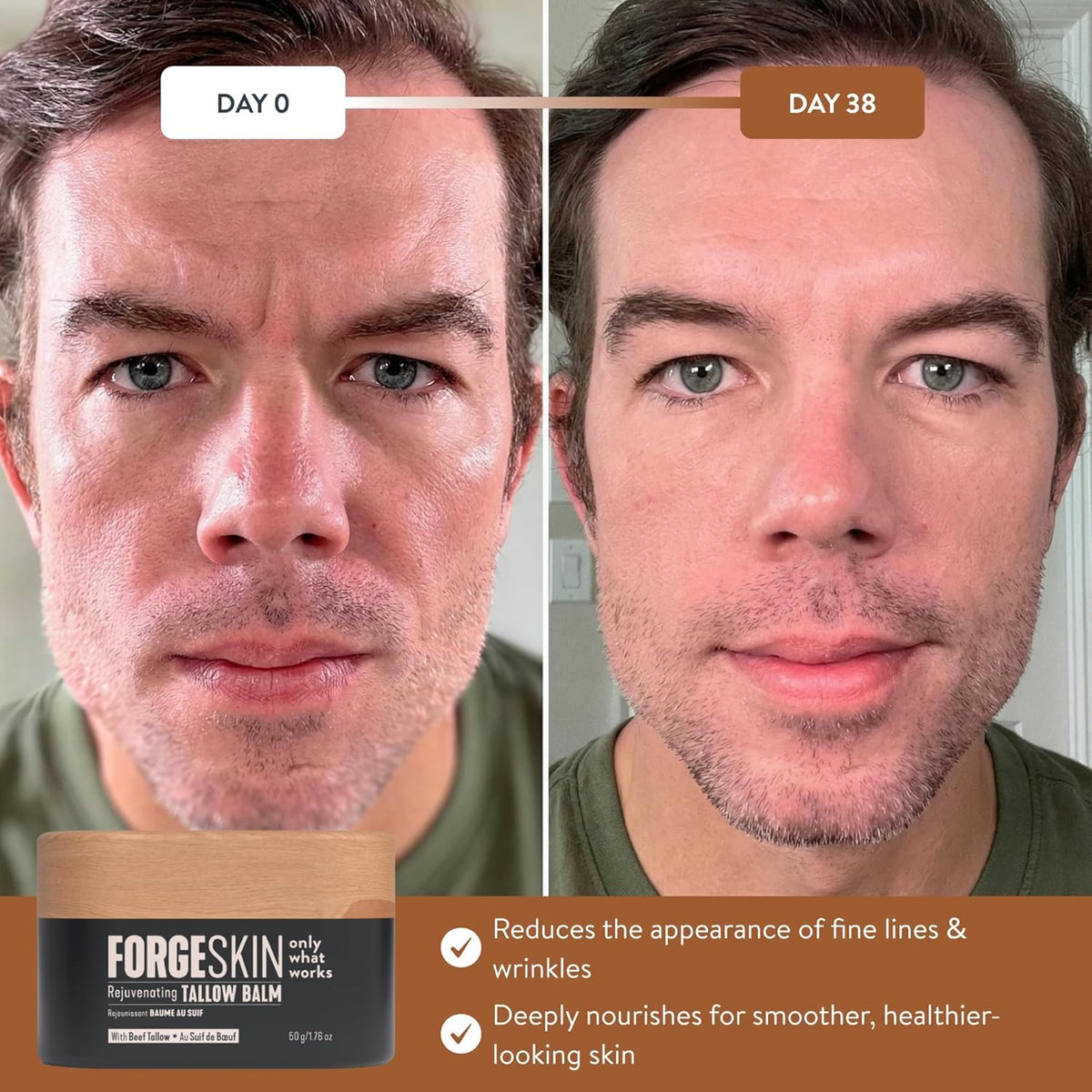 Forge Skin FORGE MEN Prime Male Anti-Aging + Health Optimization Bundle Wrinkle Defense Beef Tallow Balm Moisturizer + FORGEBODY® Beef Organ Complex Capsules Supplement for Body & Brain Function