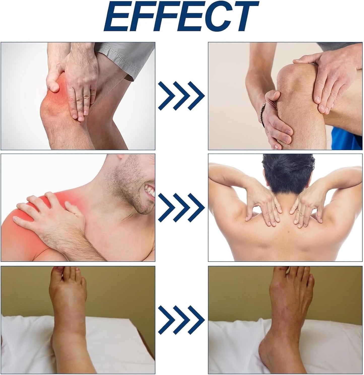 Neuropathy Relief Cream, Neurosoothe Formula Nerve Cream, Contains Capsaicin, Arnica, Menthol, Msm, and Glucosamine, Suitable for Feet, Hands, Legs