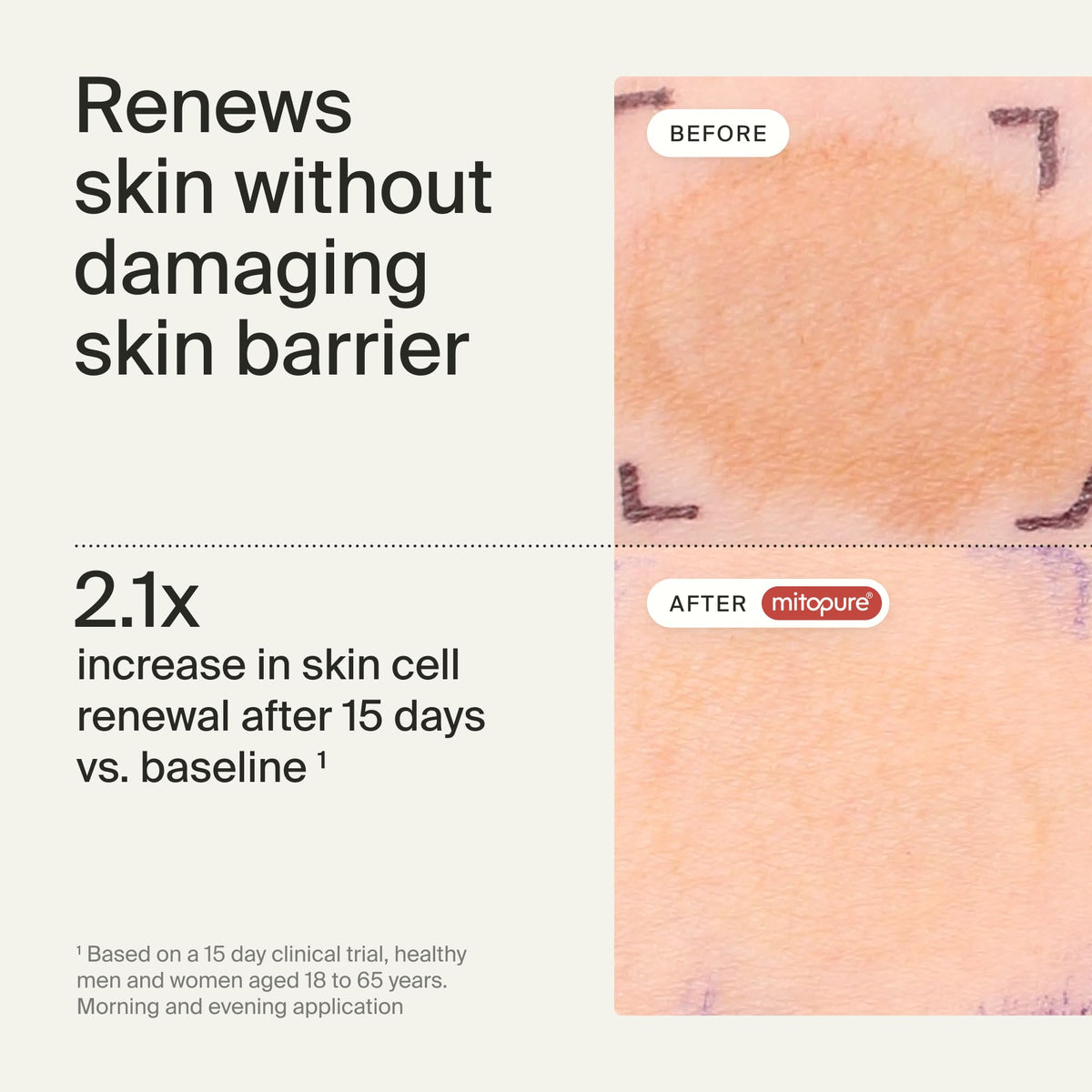 Timeline Mitopure™ Resurfacing Face Exfoliator- with Plant-Based Acids to Purify, Tone, Hydrate, Refine Texture & Unclog Pores - 3.38 Fl Oz