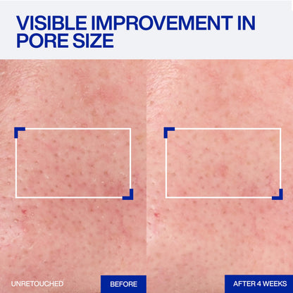 IOPE Expert Retinol RX 1% Super Bounce Serum - Gentle Anti-Aging Face Serum for Beginners - Visibly Firms Skin, Refines Pores, and Smooths Wrinkles - 1.01 fl. oz.