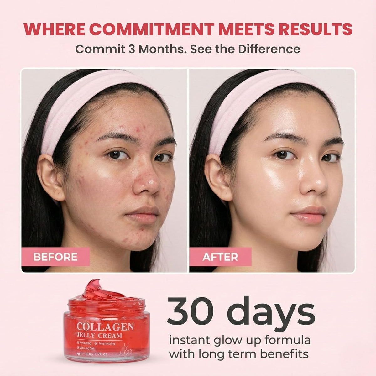 Collagen Jelly Cream — Niacinamide, Elastin & Collagen Moisturizer(1.76 oz) | 24H Glow & Hydration, Lightweight, Freeze-Dried Hydrolyzed Collagen for Skin Barrier Hydration, Plumper & Firmer looking Skin