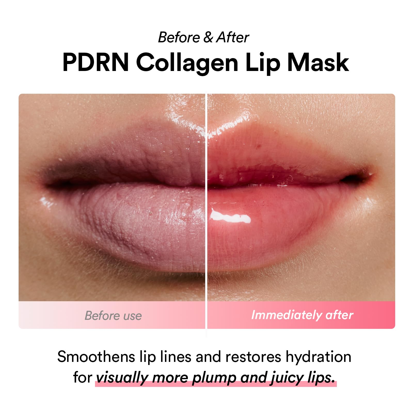 Abib PDRN Collagen Lip Mask Glazed Jelly 0.38 fl oz | Korean Lip Butter Balm Overnight Sleeping Mask Hydrating Care Moisturizer Treatment for Flakey, Dry Lips - dailyvitalstore