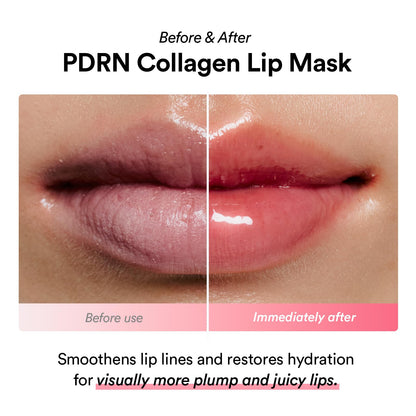 Abib PDRN Collagen Lip Mask Glazed Jelly 0.38 fl oz | Korean Lip Butter Balm Overnight Sleeping Mask Hydrating Care Moisturizer Treatment for Flakey, Dry Lips - dailyvitalstore