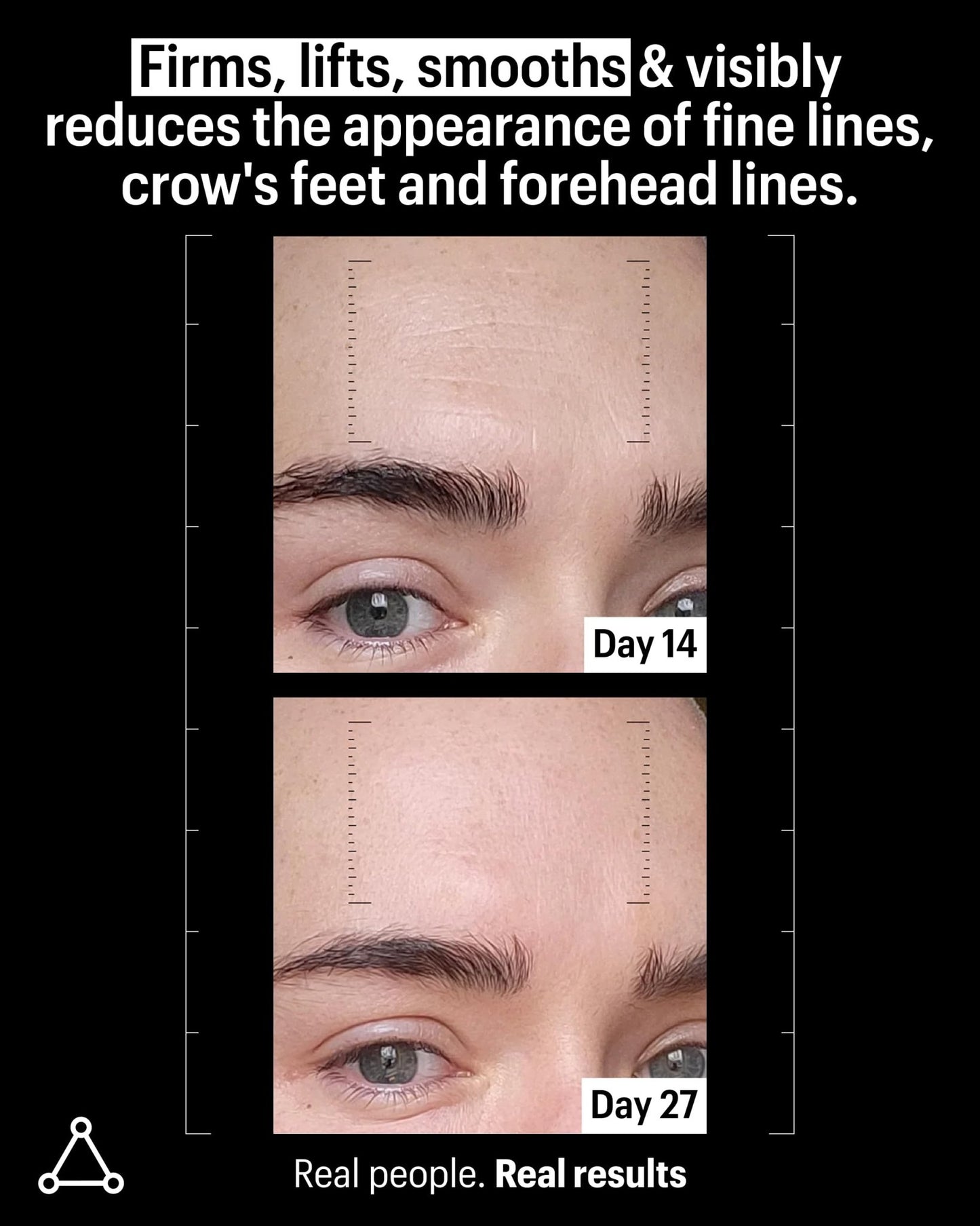 Allies of Skin Multi Peptides & Growth Factor Collagen Boosting Face Serum | Skin Tightening Anti-Aging Complex with 9% Peptides| Firms Sagging Skin & Visibly Reduces Wrinkles (1 oz) - dailyvitalstore