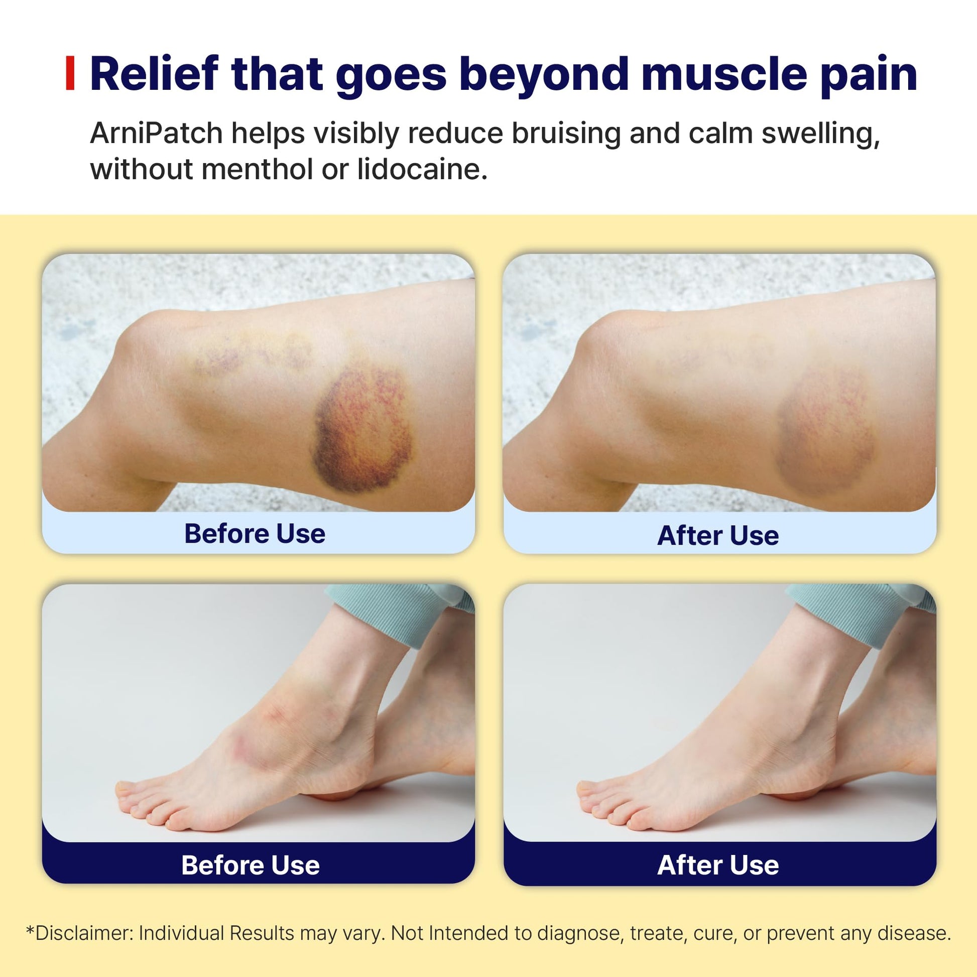 Arnica Hydrogel Pain Relief Patches | Natural Relief for Muscle, Joint, Bruises & Swelling | Flexible, Non-Greasy & Long-Lasting | Great for Back, Knee & Neck Pain (3.9"x4.7", 10, Count) - dailyvitalstore