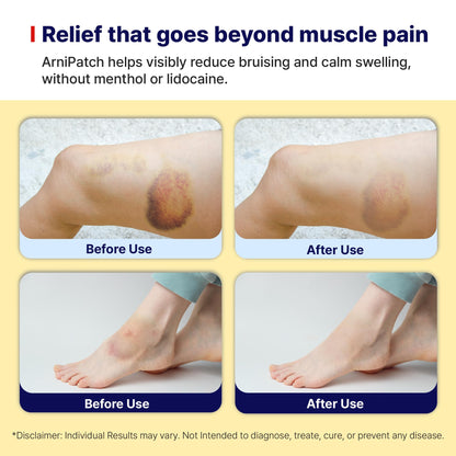 Arnica Hydrogel Pain Relief Patches | Natural Relief for Muscle, Joint, Bruises & Swelling | Flexible, Non-Greasy & Long-Lasting | Great for Back, Knee & Neck Pain (3.9"x4.7", 10, Count) - dailyvitalstore