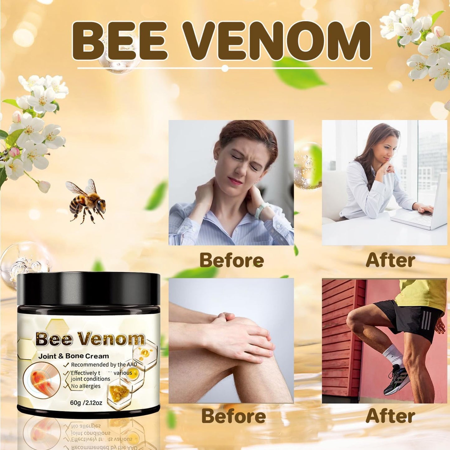 ArthroEase Bee Venom Arthritis Cream, Joint & Muscle Soothing Bee Venom Cream, Professional Bee Venom Joint Cream, Bee Venom Joint Gel - Specially for for Back, Neck, Hands, Knee (2 Bottle) - dailyvitalstore