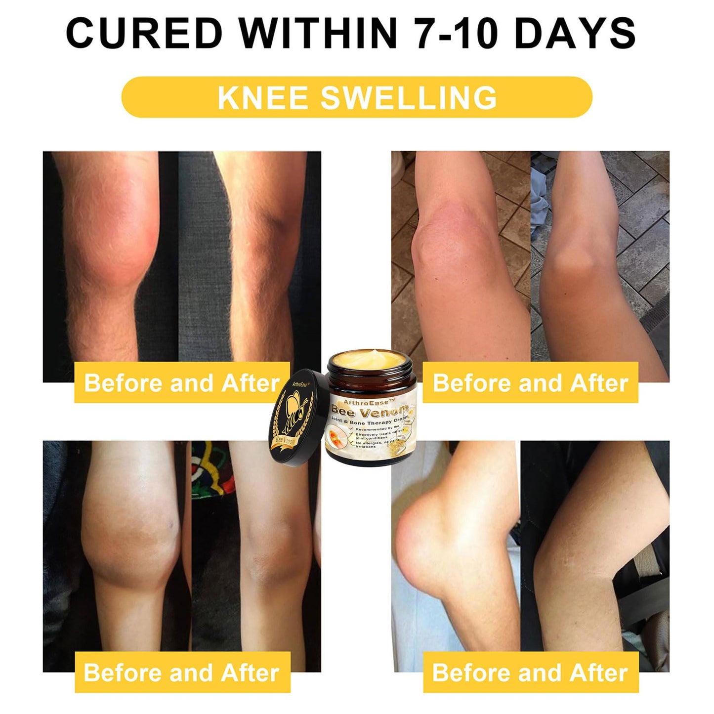 ArthroEase Bee Venom Joint and Bone Cream,ArthroEase Bee Venom Cream,Bee Venom Joint Gel,Effectively Relieve Joint discomfort (2) - dailyvitalstore