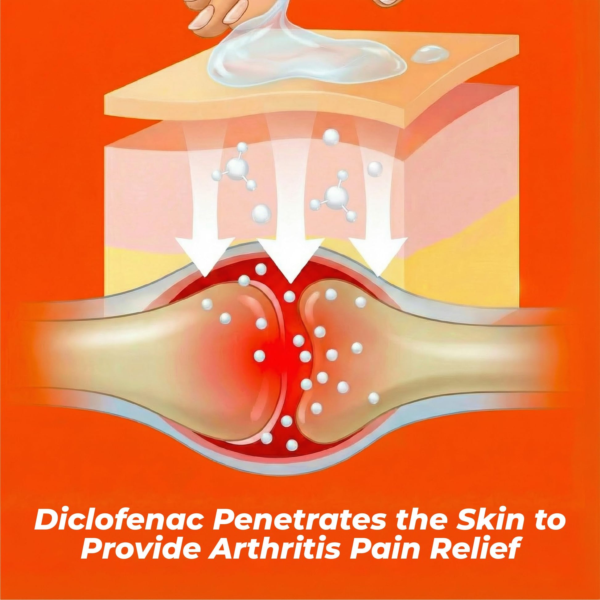 Aspercreme Arthritis Pain Relief Gel for Arthritis & Joint Pain, Non-steroidal Anti-inflammatory Topical Gel with Max-Strength Diclofenac Sodium, 50 g - dailyvitalstore