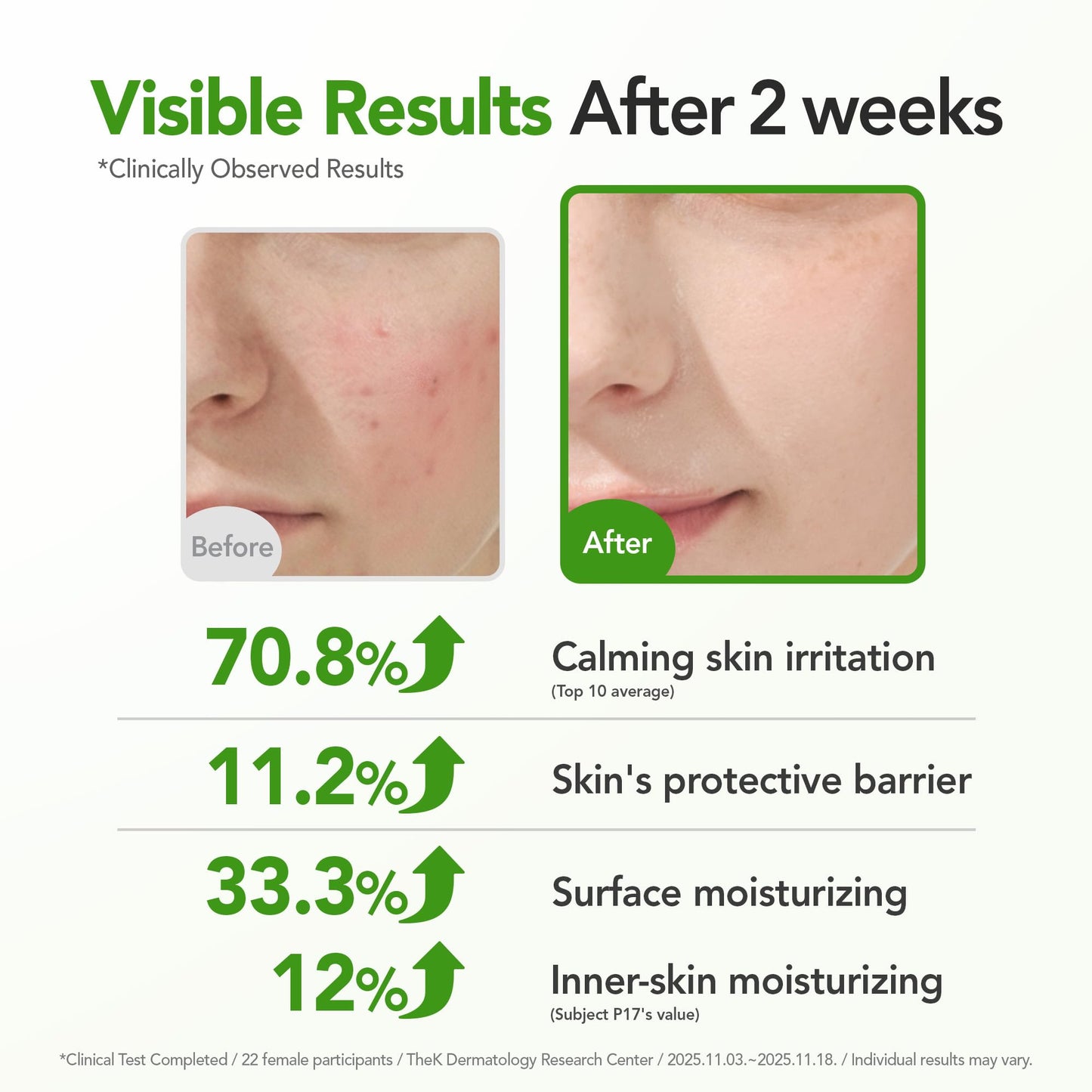 BALOOM Centella Asiatica Calming Ampoule with TECA & Niacinamide - Korean Cica Serum for Sensitive Skin - Soothing Redness Relief, - dailyvitalstore