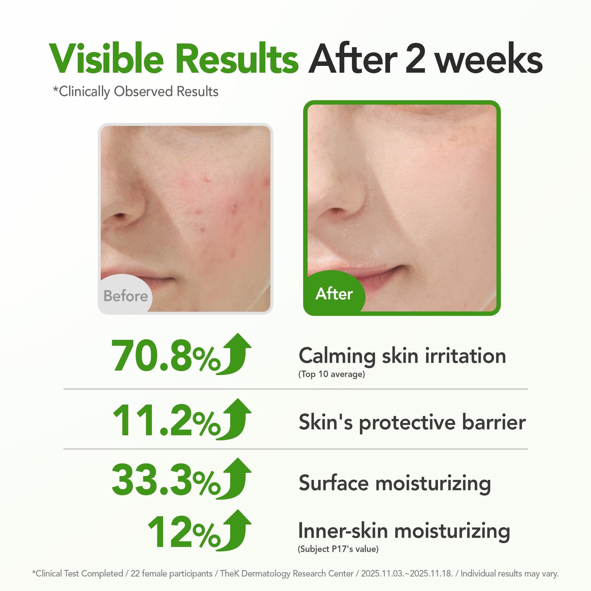 BALOOM Centella Asiatica Calming Ampoule with TECA & Niacinamide - Korean Cica Serum for Sensitive Skin - Soothing Redness Relief, - dailyvitalstore