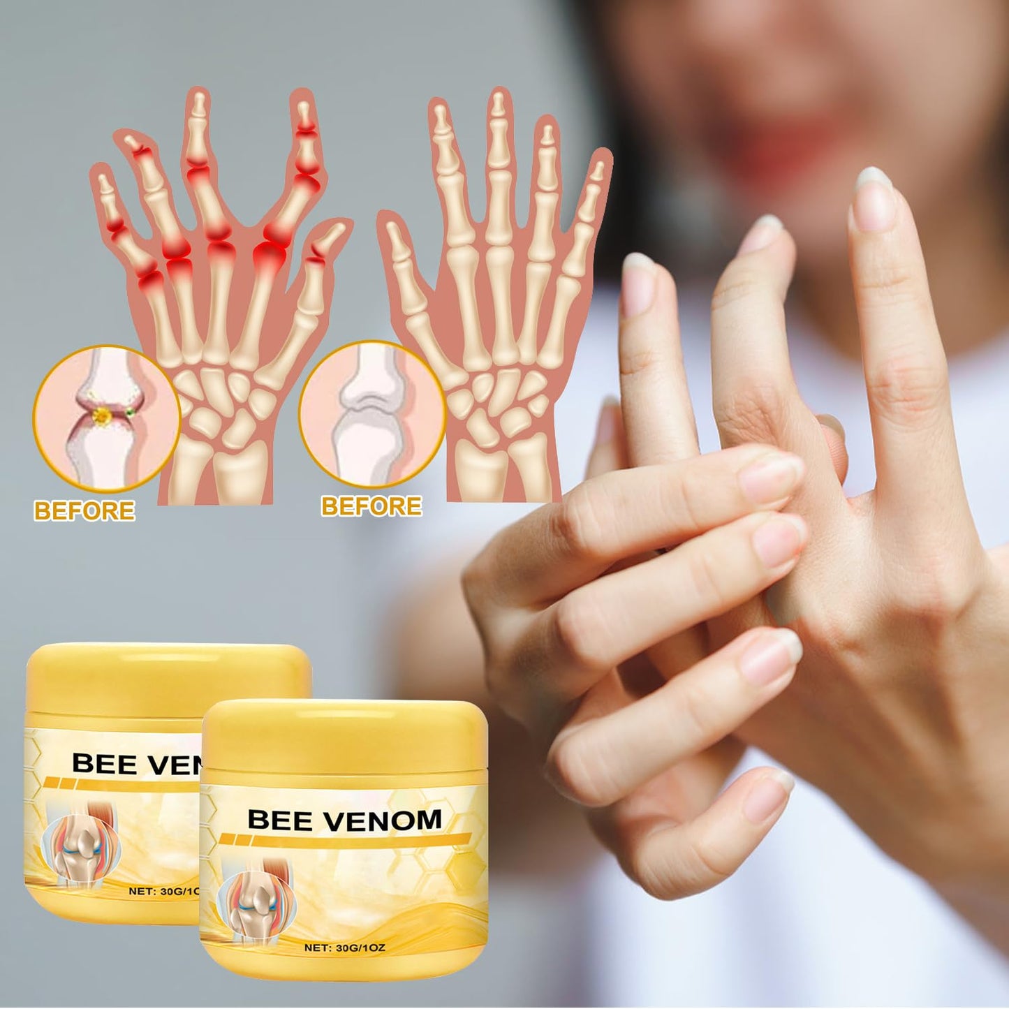 Botou 2PCS New Bee Venom Professional Joint Cream, for Neck, Waist, Back, Hands, Feet and Legs Advanced Bee Propolis Joint Cream, yellow - dailyvitalstore
