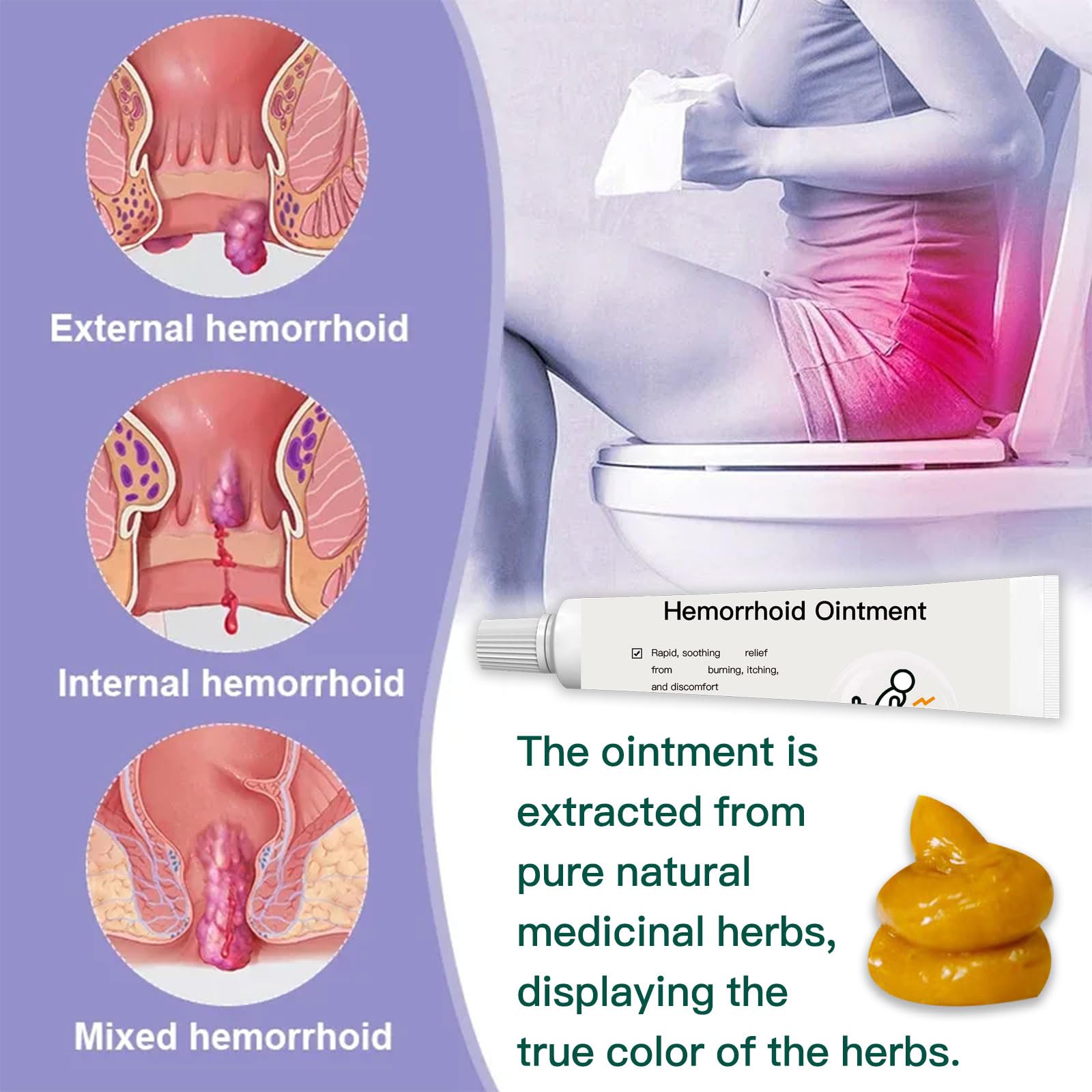 BXQJRJ Hemorrhoid Ointment,Herbal hemorrhoid Gel,Effectively relieves Anal discomfort,Suitable for Men and Women,Fast-Acting hemorrhoid Ointment (20g) - dailyvitalstore