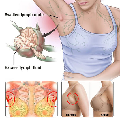 BXQJRJLymphatic Drainage Patch Lymphatic Drainage Herbal Lymphatic Drainage Care Patch Herbal Neck Patch (12) - dailyvitalstore