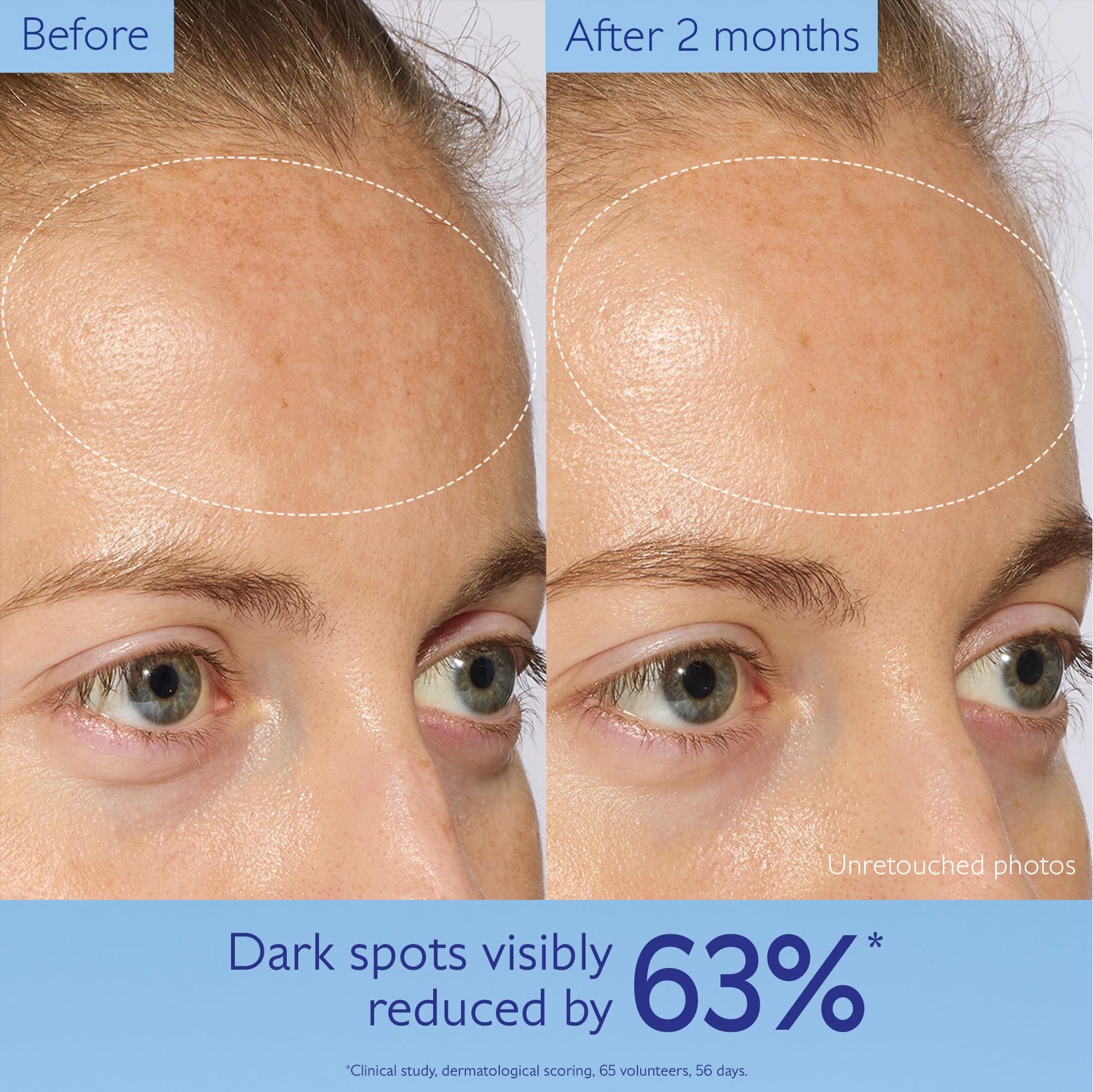 Caudalie Vinoperfect Brightening Dark Spot Serum Vitamin C Alternative - 62x More Effective than Vitamin C with Viniferine - dailyvitalstore