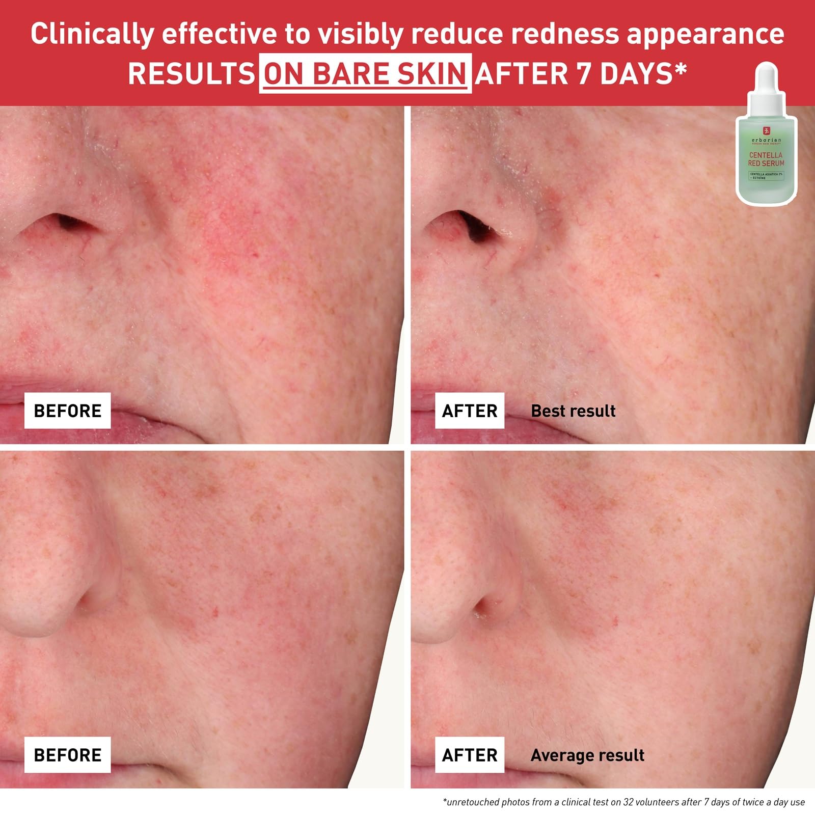 CENTELLA RED SERUM 10ML - dailyvitalstore