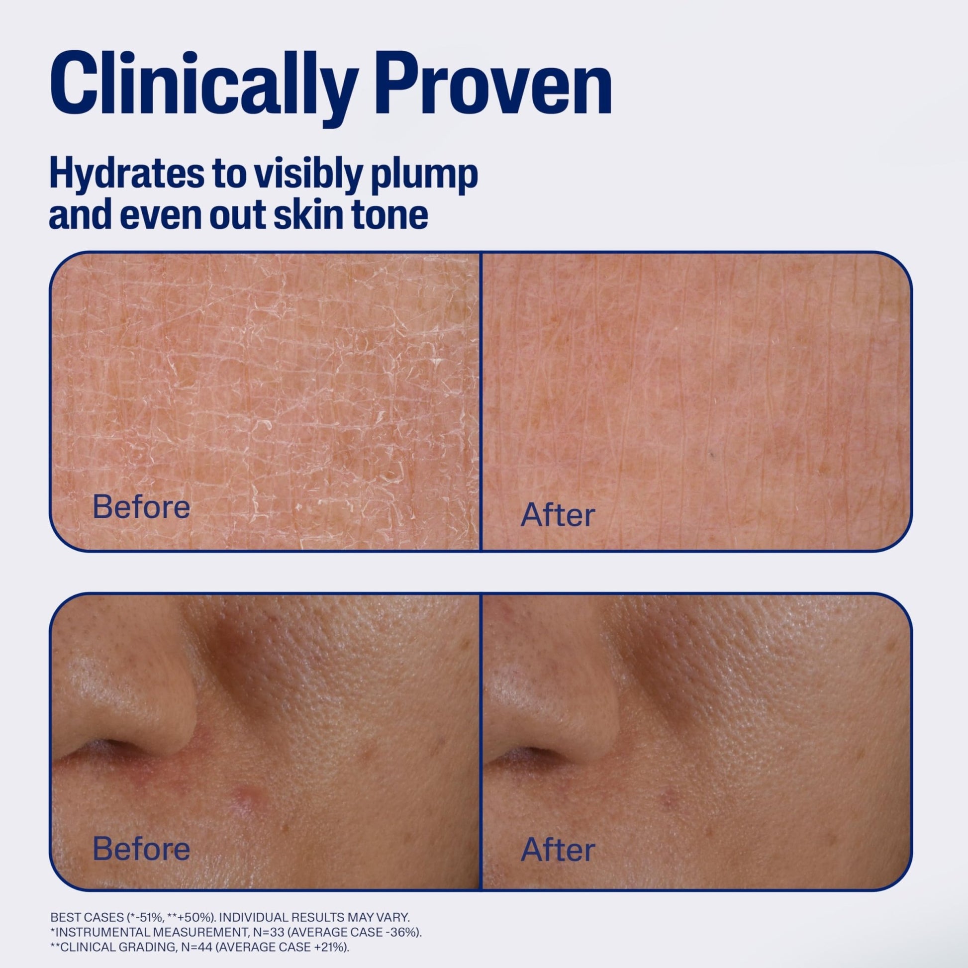 CETAPHIL Repair & Renew Night Serum for Stressed Sensitive Skin with Gallic Acid & Vitamin E, PM Face Serum, Repairs Skin Barrier Overnight - dailyvitalstore