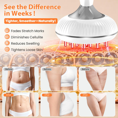 Choufaly Lymphatic Drainage Massager & Anti Cellulite Massage Tool, Helps Reduce Stretch Marks & Cellulite, for Legs, Arms & Belly, Body Sculpting Machine with Microcurrent & Light & Heat & Vibration - dailyvitalstore