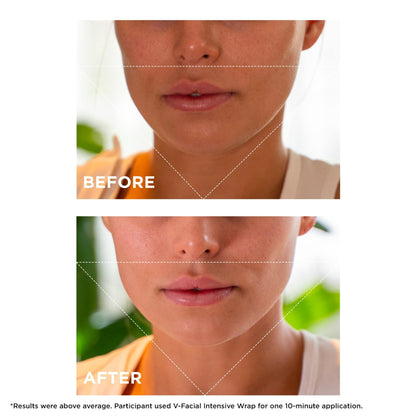 Clarins V-Facial Intensive Wrap Face Mask | Award-Winning Facial Contouring Mask | Visibly Reduces Puffiness and Swelling Caused by Stress,Heat and Hormonal Changes - dailyvitalstore