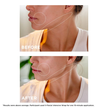 Clarins V-Facial Intensive Wrap Face Mask | Award-Winning Facial Contouring Mask | Visibly Reduces Puffiness and Swelling Caused by Stress,Heat and Hormonal Changes - dailyvitalstore