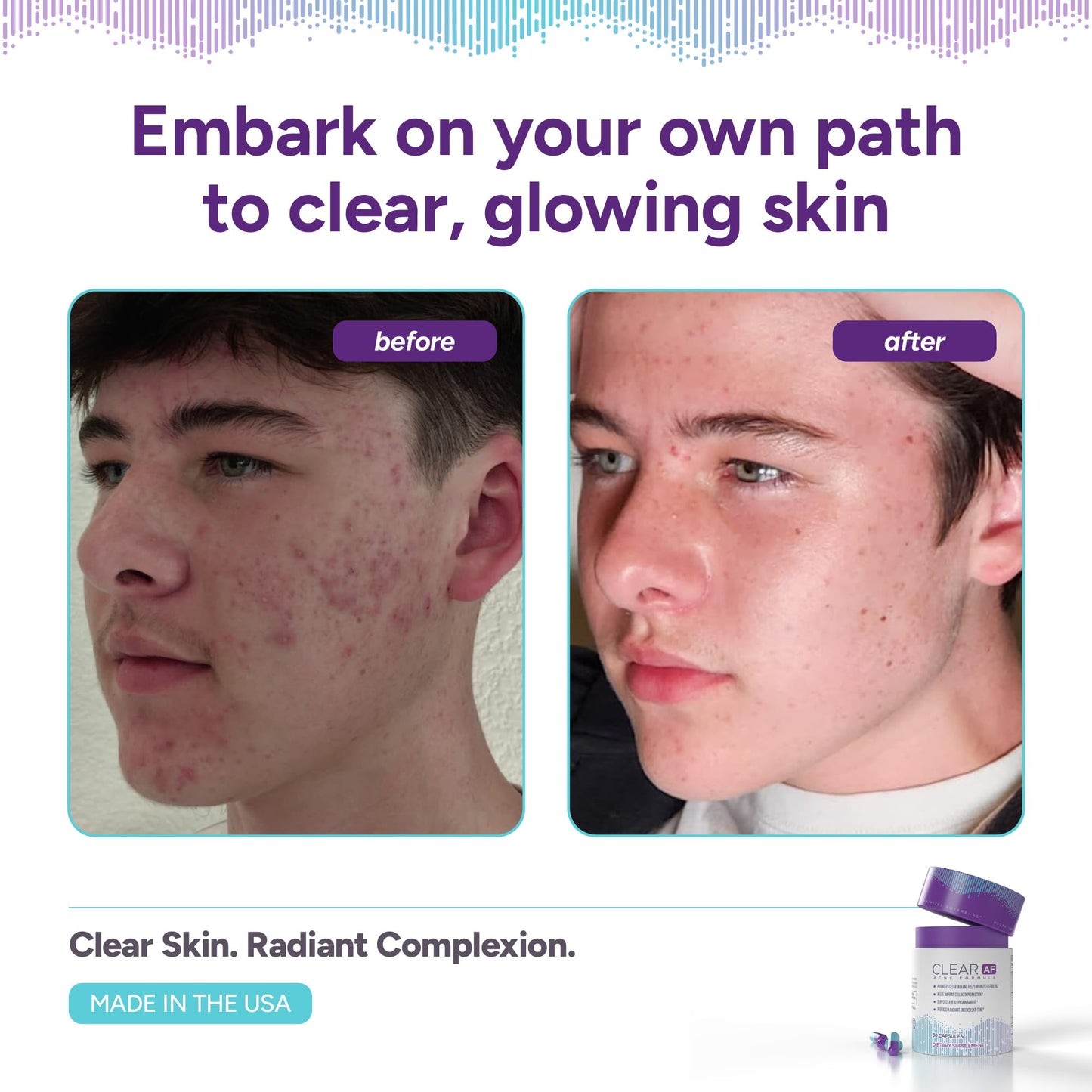 Clear AF Clear Skin Supplement | Skin Barrier Hydration & Clear Complexion Support with Vegan Ceramides, Zinc, Vitamin D3, B6, Riboflavin & Thiamine | Vegan Capsules | 30-Day Supply - dailyvitalstore
