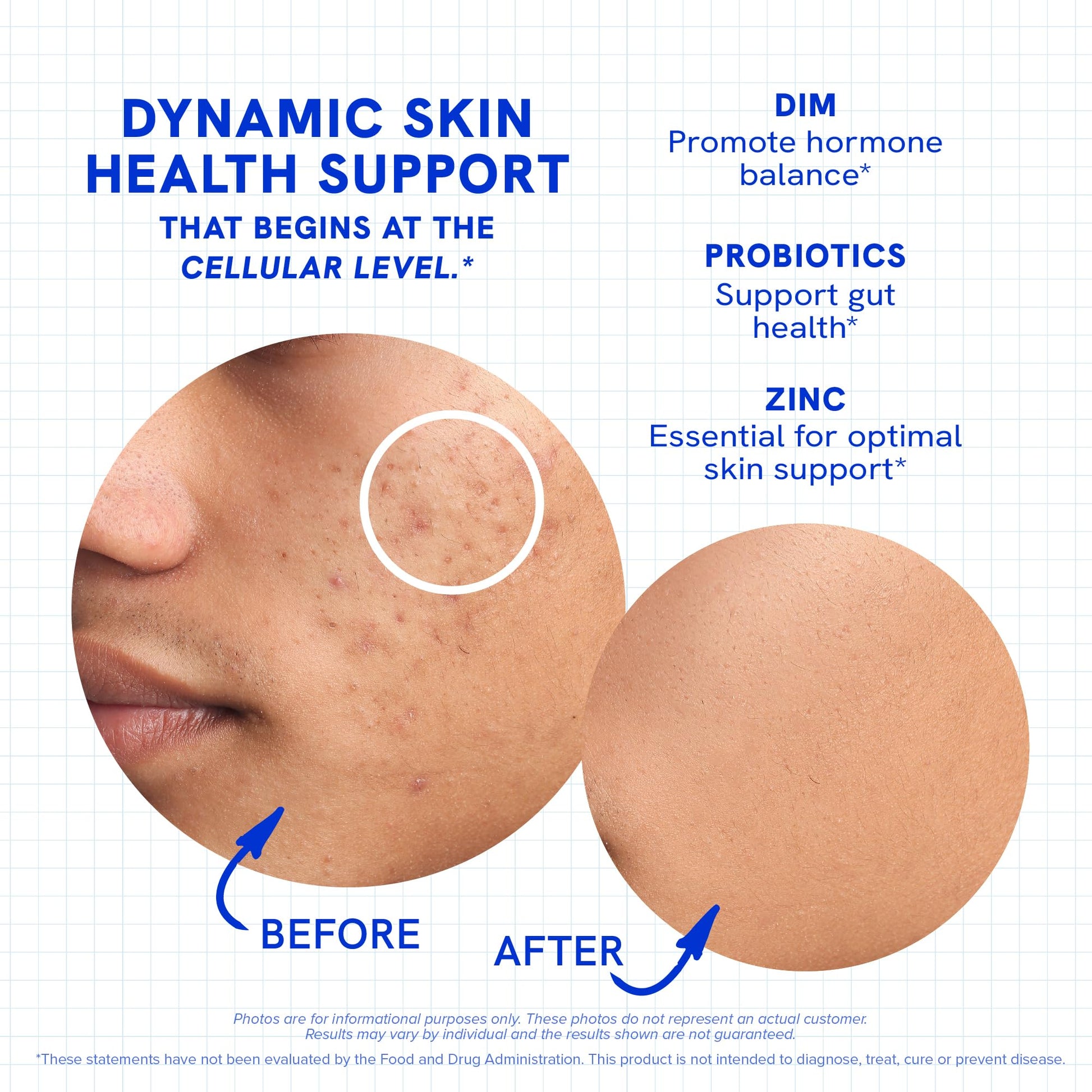 Clear Skin Supplement with Zinc, DIM & Probiotics | 3-in-1 Balance, Glow & Health Skin Support | Triple Action Hyaluronic Acid, Niaciminide & Vitamins for Hormone, Complexion & Gut Support | 180 Ct - dailyvitalstore