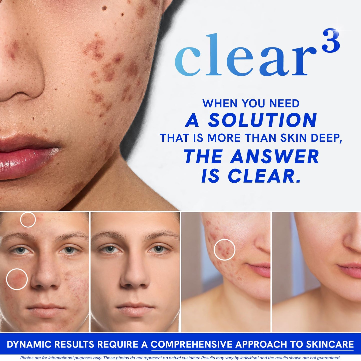 Clear Skin Supplement with Zinc, DIM & Probiotics | 3-in-1 Balance, Glow & Health Skin Support | Triple Action Hyaluronic Acid, Niaciminide & Vitamins for Hormone, Complexion & Gut Support | 180 Ct - dailyvitalstore