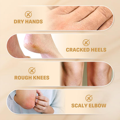 Clyecfra 60% Urea Cream with 2% Salicylic Acid, Urea Cream 60 Percent for Feet & Hands- Maximum Strength Moisturizer for Rough, Dry, Thick & Cracked Skin, Callus Remover, Deep Hydration, 150g - dailyvitalstore