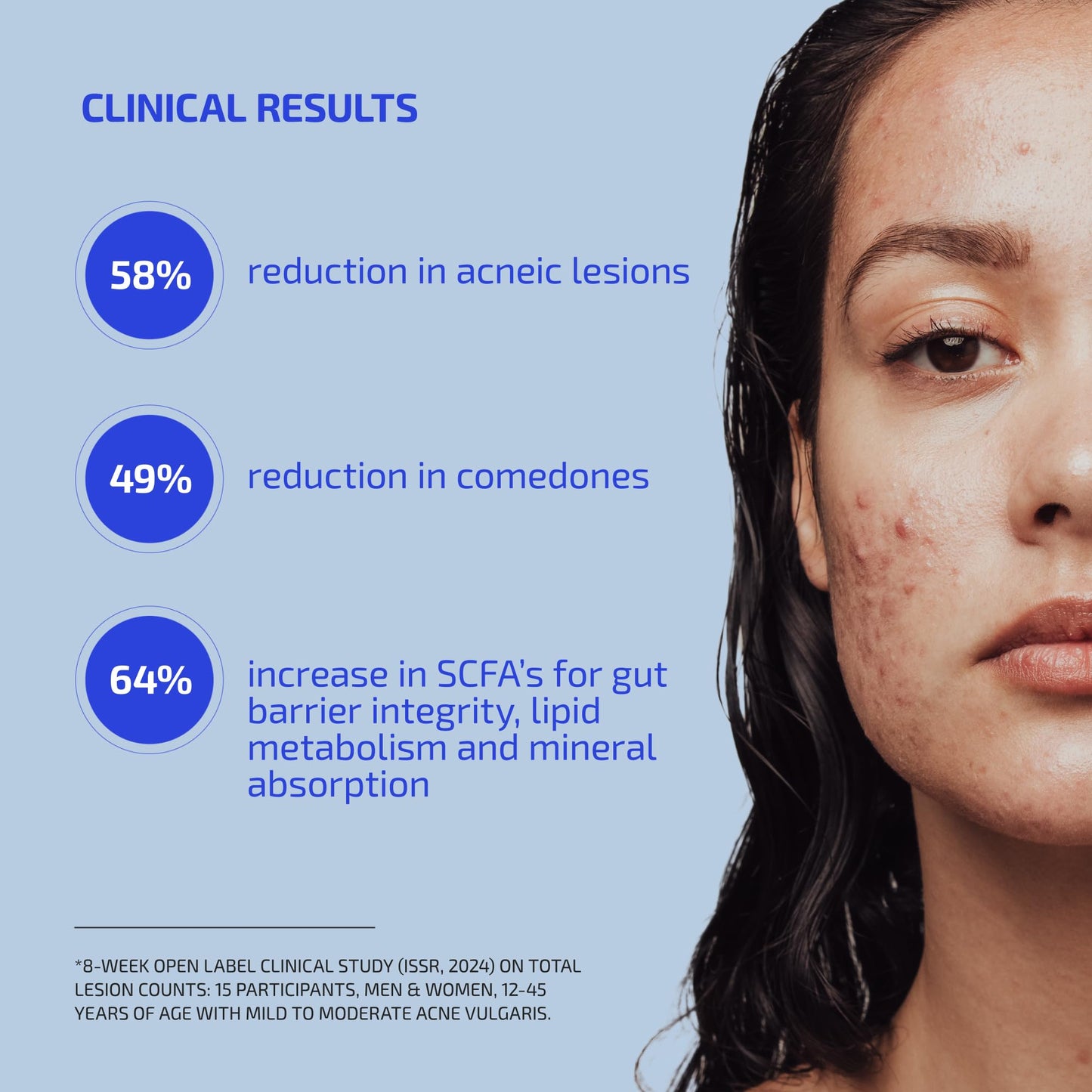 Codex Labs Shaant Clear Skin Supplement – 60 Vegan Capsules | Acne Probiotics with 9-Strain Blend, Green Tea EGCG & Guggul – Daily Support for Acne-Prone Skin & Clear Complexion - dailyvitalstore