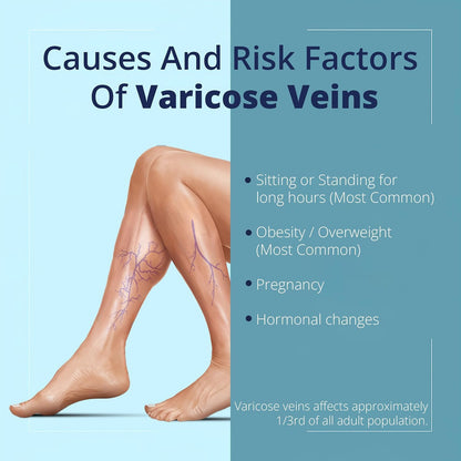 Cream Ayurvedic Solution for Management of Varicose Veins, Spider Veins, Varicocele Helps Reach The Root Cause of varicose Veins Reduces Cramps, Itching & Swelling. Single Tube (25 GMS). - dailyvitalstore
