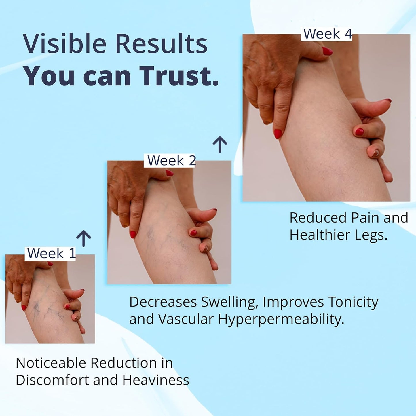 Cream Ayurvedic Solution for Management of Varicose Veins, Spider Veins, Varicocele Helps Reach The Root Cause of varicose Veins Reduces Cramps, Itching & Swelling. Single Tube (25 GMS). - dailyvitalstore