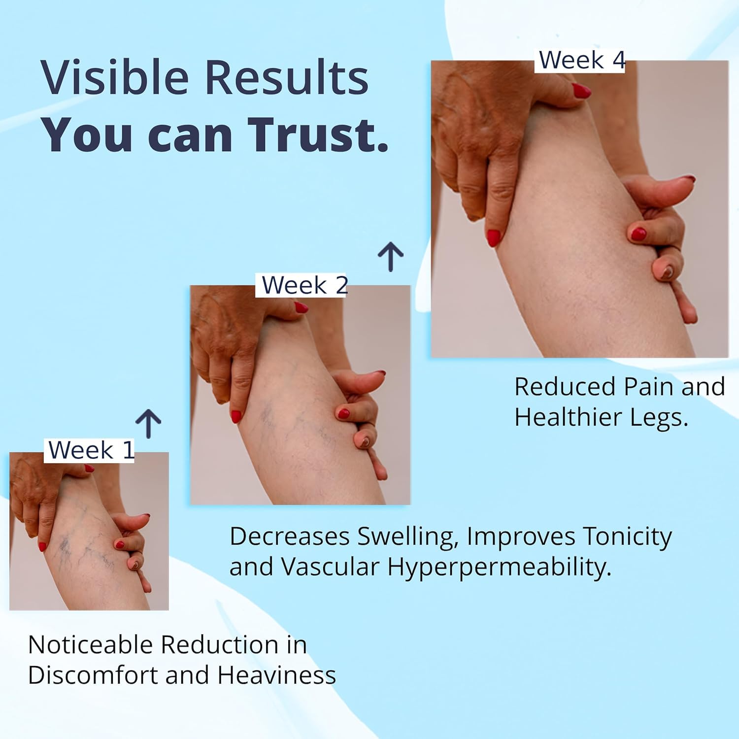 Cream Ayurvedic Solution for Management of Varicose Veins, Spider Veins, Varicocele Helps Reach The Root Cause of varicose Veins Reduces Cramps, Itching & Swelling. Single Tube (25 GMS). - dailyvitalstore