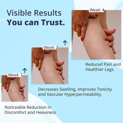 Cream Ayurvedic Solution for Management of Varicose Veins, Spider Veins, Varicocele Helps Reach The Root Cause of varicose Veins Reduces Cramps, Itching & Swelling. Single Tube (25 GMS). - dailyvitalstore
