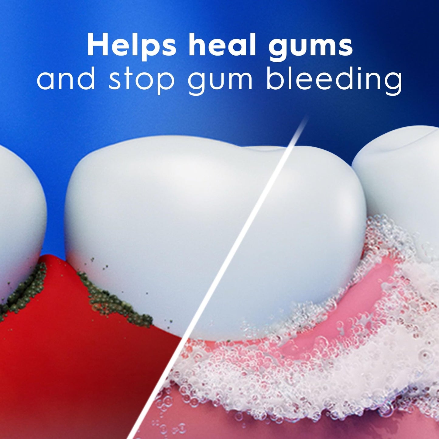 Crest Pro-Health Gum Detoxify Plus Toothpaste 4.5 oz Pack of 3 - Antibacterial Fluoride Toothpaste, Sensitivity Protection - dailyvitalstore