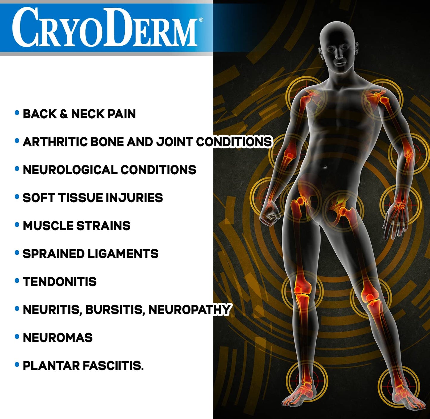 CryoDerm 4 oz Spray Cold Therapy (6 Pack) - dailyvitalstore
