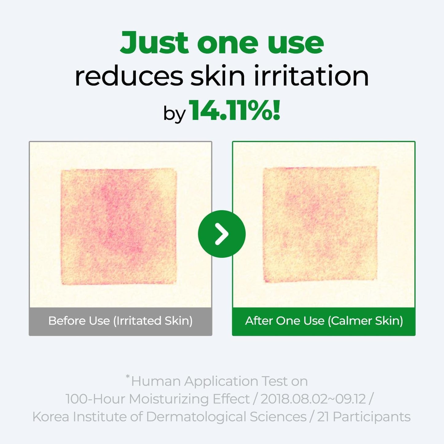 Cure Intensive 2X Cream, Premium Aloe Deep Moisturizing Multi Balm, Korean Skincare, Face Moisturizer for Dry Skin (Pack of 1) - dailyvitalstore
