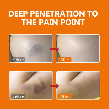 DERMFREE Pain Relief Cream - dailyvitalstore