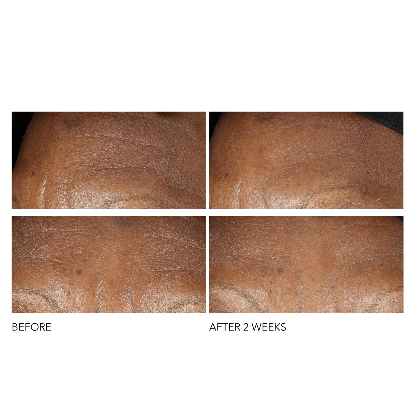 Dr Dennis Gross Advanced Retinol + Ferulic Intense Wrinkle Cream | Intensely Hydrating to Visibly Transform Skin and Repair the Moisture Barrier | 2 oz - dailyvitalstore