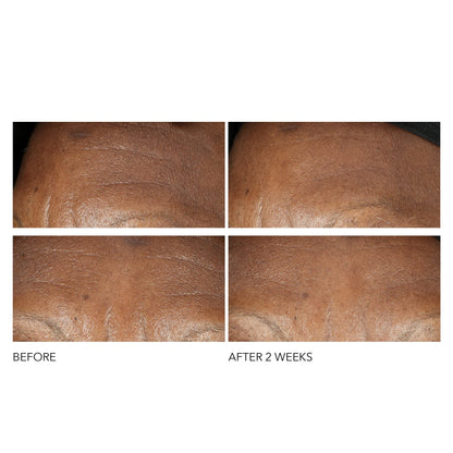 Dr Dennis Gross Advanced Retinol + Ferulic Intense Wrinkle Cream | Intensely Hydrating to Visibly Transform Skin and Repair the Moisture Barrier | 2 oz - dailyvitalstore