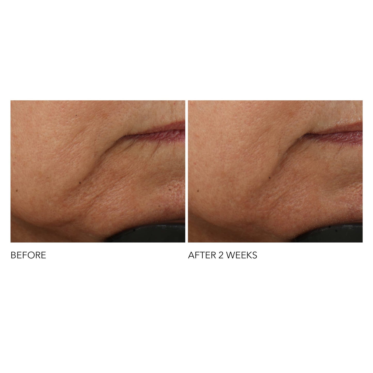 Dr Dennis Gross Advanced Retinol + Ferulic Intense Wrinkle Cream | Intensely Hydrating to Visibly Transform Skin and Repair the Moisture Barrier | 2 oz - dailyvitalstore