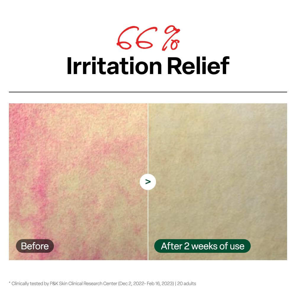 Dr. G R.E.D. Blemish Clear Soothing Toner - Korean Soothing Toner for Glowing Skin - Soothes Irritation Clear Skin - Mild Exfoliant - dailyvitalstore