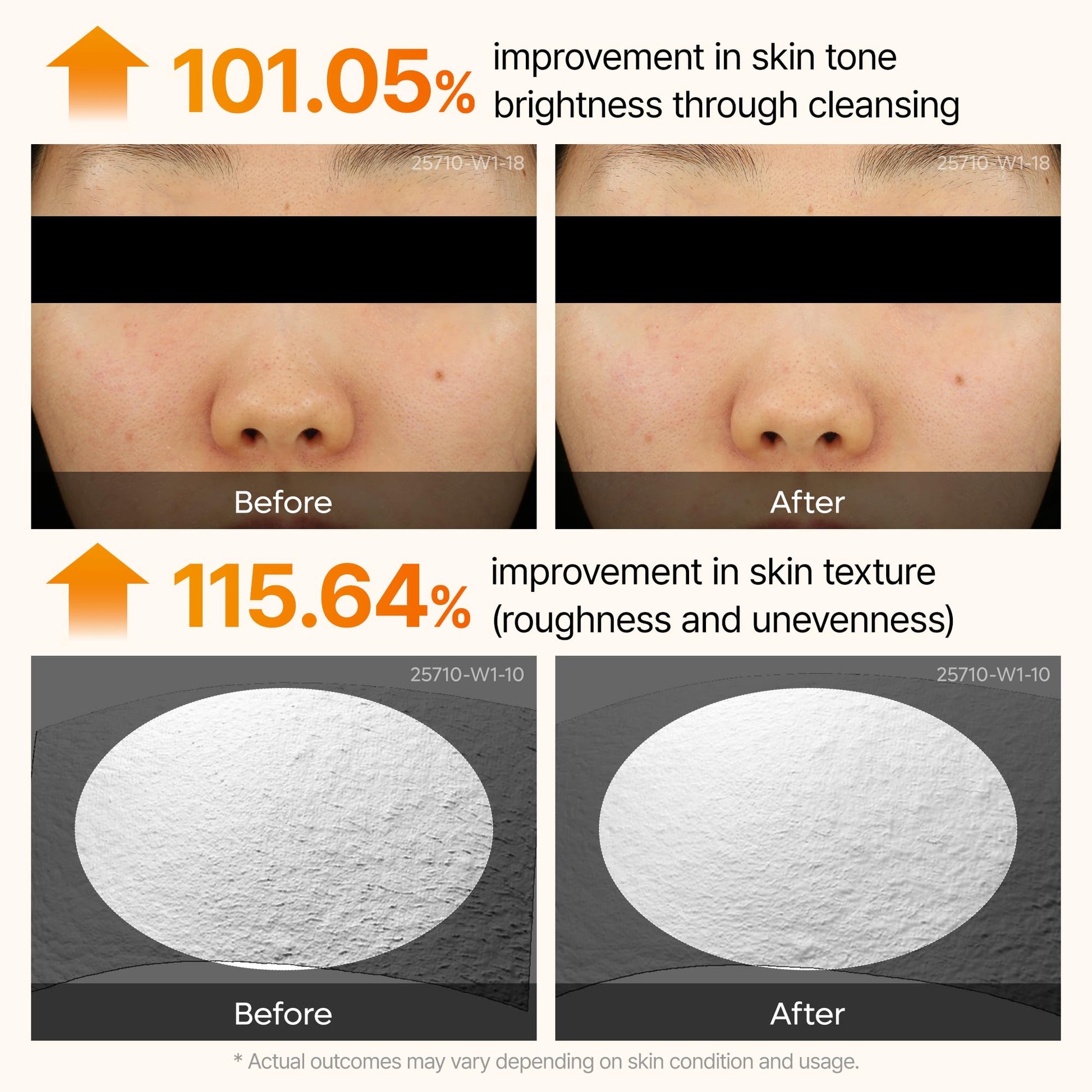 Dr. Melaxin Peel Shot Kojic Acid Turmeric Serum – Exfoliating Dark Spot Corrector with AHA/BHA & Niacinamide, Brightening & Even Tone - dailyvitalstore