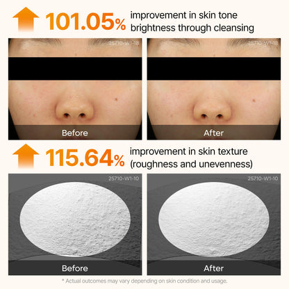 Dr. Melaxin Peel Shot Kojic Acid Turmeric Serum – Exfoliating Dark Spot Corrector with AHA/BHA & Niacinamide, Brightening & Even Tone - dailyvitalstore