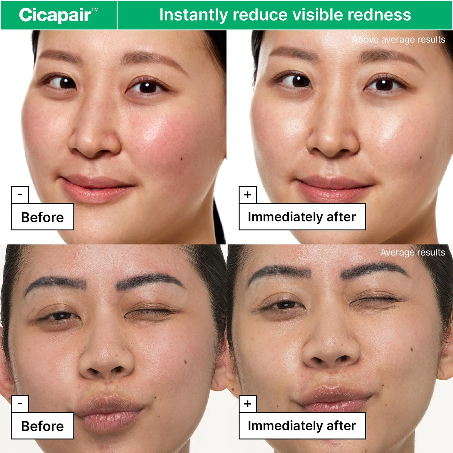 Dr.Jart+ Cicapair Sensitive Skin Korean Face Moisturizer for Redness and Barrier Repair with Centella Asiatica | Korean Skin Care | Travel Size, 0.51 Fl Oz - dailyvitalstore