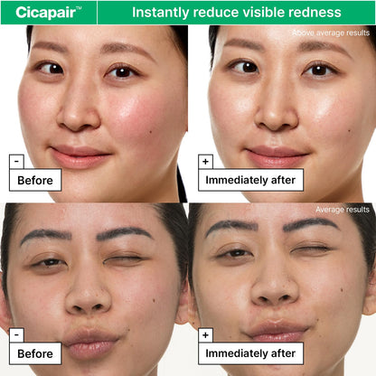 Dr.Jart+ Cicapair Sensitive Skin Korean Face Moisturizer for Redness and Barrier Repair with Centella Asiatica | Korean Skin Care | Travel Size, 0.51 Fl Oz - dailyvitalstore